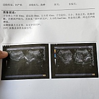 看不懂  早早孕是什么意思