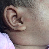 宝宝可能得小湿疹了 什么时候会好呢？暂时不打算给她用药 看看过两天会不会下去呢？有同样的处境吗？好...