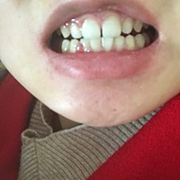 牙龈肿痛，不知道怎么办