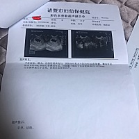 大神姐姐妹妹们，会用Ramzi理论看出宝宝性别的吗？分别是7周阴超和10周腹超，谢谢啦