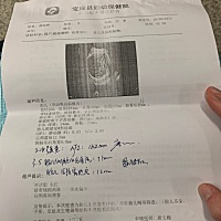 现在孕35周，说侧脑室跟后颅窝池都偏宽，我们这县医院让我去南京查，我去了南京，南京医生说我这个情况...