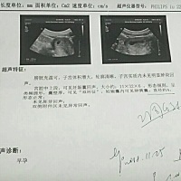 各位宝妈，听说妊娠囊能看男女，帮我看下哦