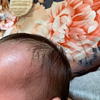 宝宝头上这个怎么整