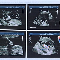 孕15周，有没有会看的，帮忙看看孩子性别呀。