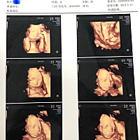 一次过的四维真的太开心。 提前一天晚上就宝宝爸就开始和宝宝商量，让Ta要乖一点，第一次能让爸爸看到脸...