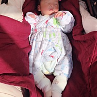 小宝贝左眼睛老是流眼泪 黄色的 你们家宝宝有没有