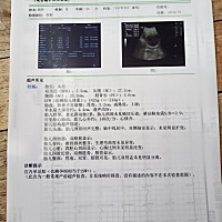 大家帮我看看是男孩女孩