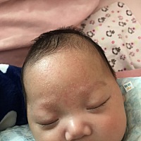 请问有经验的宝妈们 这额头上的是什么啊？怎么祛除啊？