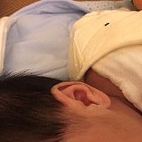 宝妈们知道这是什么吗？怎么处理