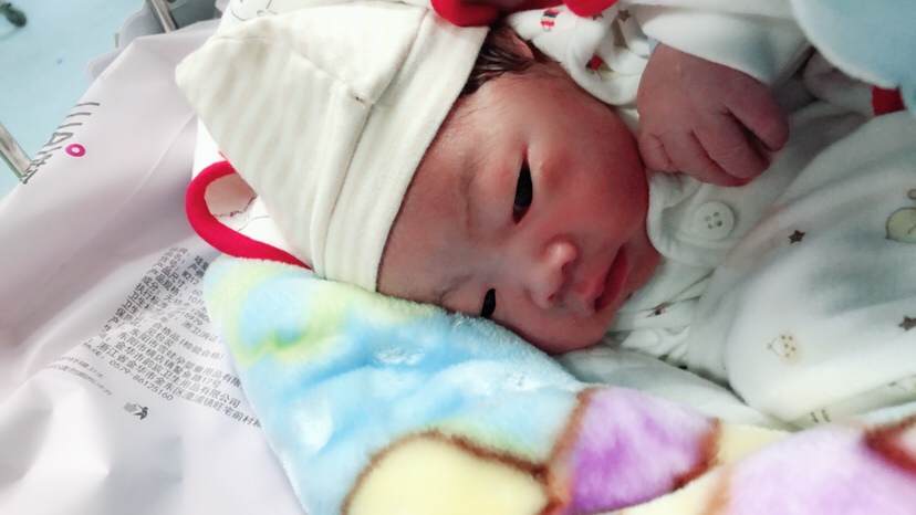 刚生出来十几分钟的时候还肿肿的