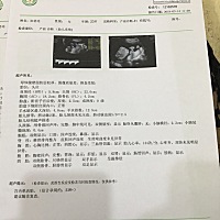 能看出性别嘛？