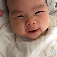 嘴巴下面长了一个这个什么东西，好多天了，有类似情况的吗？怎么处理