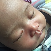 一个多月的宝宝出现眼屎多 这是怎么了 ？