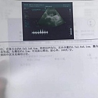 检查正常，能看出来是佩奇还是乔治么？