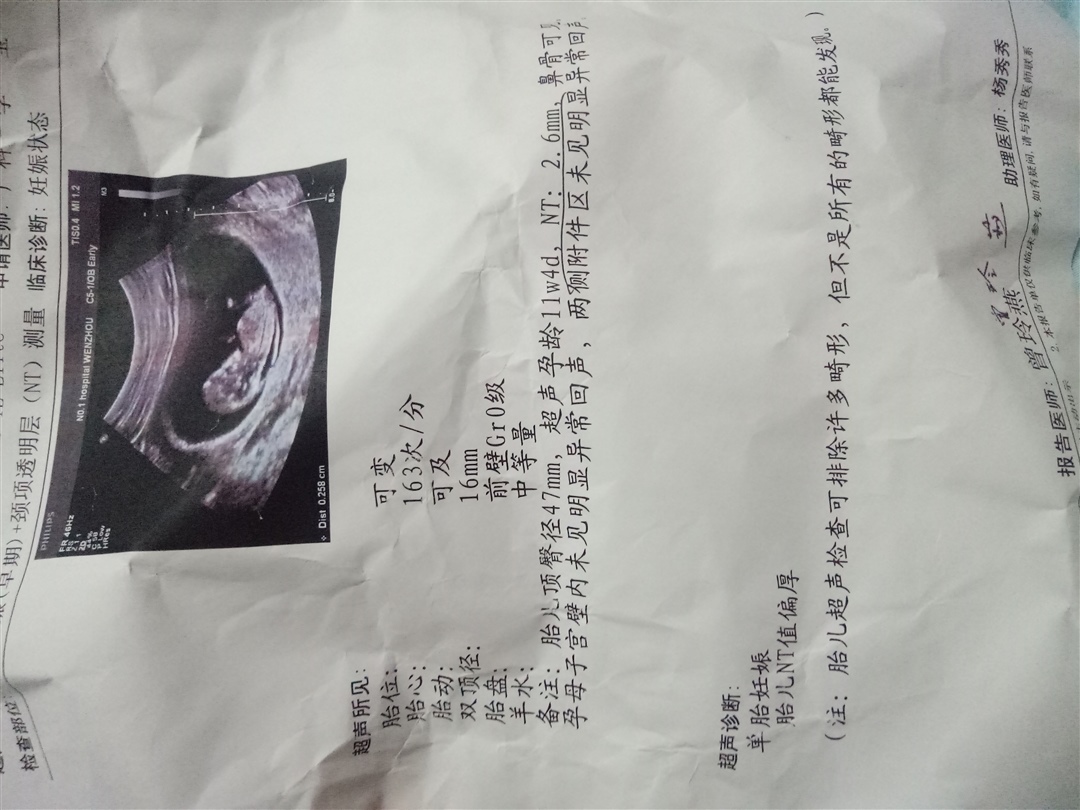 希望知道的宝妈帮我看看这个检查结果会不会有问题，好担心