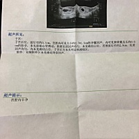 7周多，只见胎芽不见胎心。还能用药保胎吗？