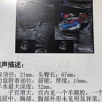 每次去医院做b超，做b超的医生都会不约而同告诉我：孩子长得很好。  本来一直纠结是否留下，这些话反而...