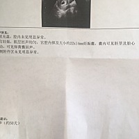 求解，是男还是女？
