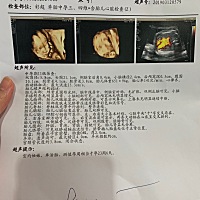 有谁会看是男宝还是女宝呀？