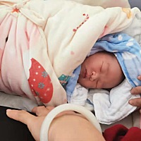 3月13号剖出来了一枚小公主😄😄😄😄😄😄😄😄😄😄