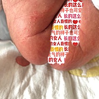 宝宝刚出生17天，从昨天晚上到今天特闹，睡觉一放下去就容易哭，而且睡觉老是爱突然颤抖，屁股也长了这...