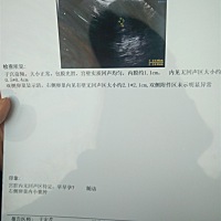 HCG升高，孕酮反降低是什么原因？我要注意哪些问题？ 2019年2月25号发烧，试孕纸显示未怀孕，吃了3次退...