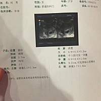 刚做的检查，这个头臀长正常吗？