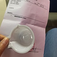 3月14日 排卵第三天  需要到医院照b超和拿之前验血的结果 发现了宫腔粘连 需要做一个小手术 不影响正常...