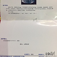 医生说偏小啊，13周多了，才显示11周6天