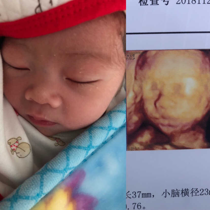 孕之前我就习惯了熬夜，所以整个孕期都在熬夜，