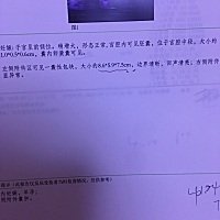 怀孕查出有囊肿怎么办？