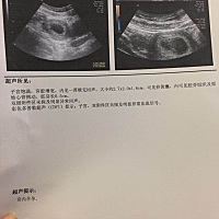 二胎差不多四个月，肚子就这么大了，附上第一次检查B超单，有会看男女的大神吗？帮忙看看，第一胎姑娘，...
