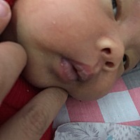 为什么宝宝的嘴巴感觉有点发干，是上火了吗？，PS最后一张图片是昨天拍的，昨天感觉跟今天的嘴巴不一样...