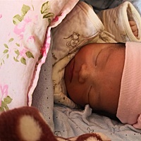 感觉宝宝皮肤好黄啊