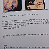 右侧的图，是宝宝的脑袋吗，能看出大概的样子吗，我总觉得我看到了孩子的小鼻子，不知道是不是