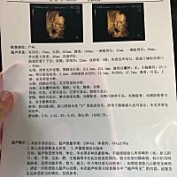 今天去做了四维啦，感觉宝宝鼻子嘴巴好大哦😂😂😂求助万能的孕妈圈，有谁能看出来是男宝还是女宝...