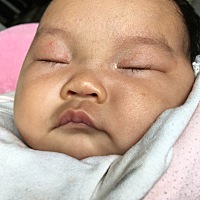 脸上长的这是什么？唉～