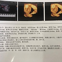 刚通过四维 好奇男女 有会看的朋友告知一下