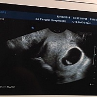 谁能帮我看看乔治还是佩奇呀。❤️❤️