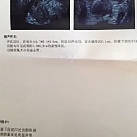 剖腹产56天了 下面还是不干净 不是有淡黄色水 就是淡粉色血 虽然量特别少 产后去复查前壁下段切口处有宫...