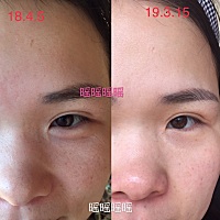 有了宝宝后，你的皮肤有多糟？前几年，我的皮肤还算水嫩，至少第一次见的人，还总能听到你的皮肤真好这...