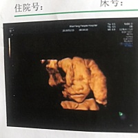 前天做了四维，我的猪北鼻还是个尖下巴，看着是个女孩子哦，还挺可爱的