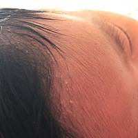 宝宝头上起皮是怎么回事呀，有宝妈知道吗？要怎么解决呢！