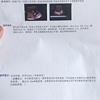 第一次发帖，NT值正常，但是写的好简单，大家帮忙看一下我这个NT过了没有～