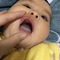 宝宝六个月，昨晚发现上牙床有这种东西，算什么来的？有谁知道呢？