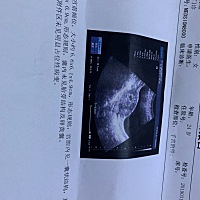 孕5➕3，胎囊的大小。求助各位姐妹数值为什么后两个相同