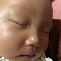 眉毛下面白白的点以后会是痣吗