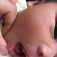 宝宝的嘴唇和嘴巴内壁都有一小块的发白，是怎么回事呀，是不是吃奶都会有的