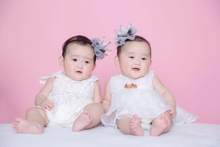 单绒双羊的双胞胎为什么不像呢