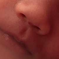 宝宝现在20天了，我发现她鼻子和眼皮有点红，好担心是胎记，每次想到这个事情心里面就烦躁，宝妈们帮我...